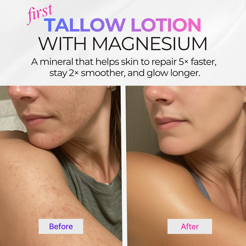 Beef Tallow Body Lotion with Magnesium, Shea Butter, Avocado, Honey - Natural Lotion with Vitamin E - Fast Absorbing, Non-Greasy Moisturizer for Dry & Sensitive Skin, Daily Hydrating Body Cream 8 Fl Oz (Pack of 1)