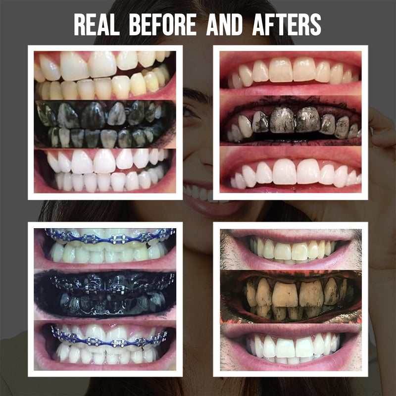 [Australia] - Premium Activated Charcoal Natural Coconut Teeth Whitening Powder - Safe for Enamel to get a Whiter and Brighter Smile - Organic Toothpaste Detoxifier 