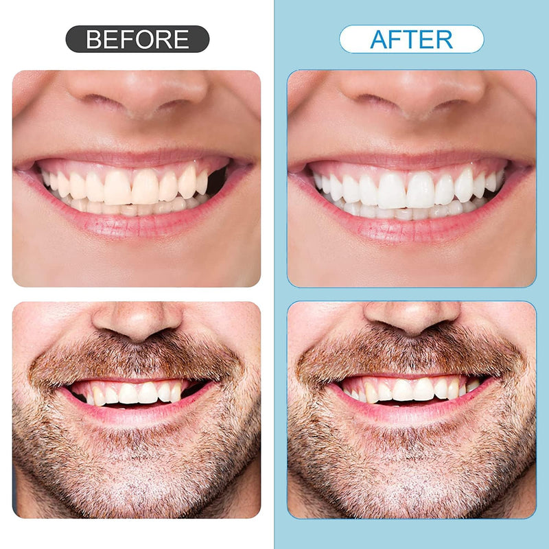 [Australia] - Tooth Repair KitÔºåTemporary Natural Shade for Filling The Gap, Moldable Thermal Beads Replacement Kit Replace The Missing or Broken Tooth-6PCS-D36 