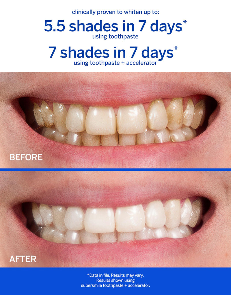 Supersmile Fluoride-Free Whitening System, 1.4 Oz Travel Size, TSA-Approved | Toothpaste + Accelerator Travel Duo, Whitens 6 Shades in 7 Days, Original Mint, Veneer Safe, Calprox® Powered