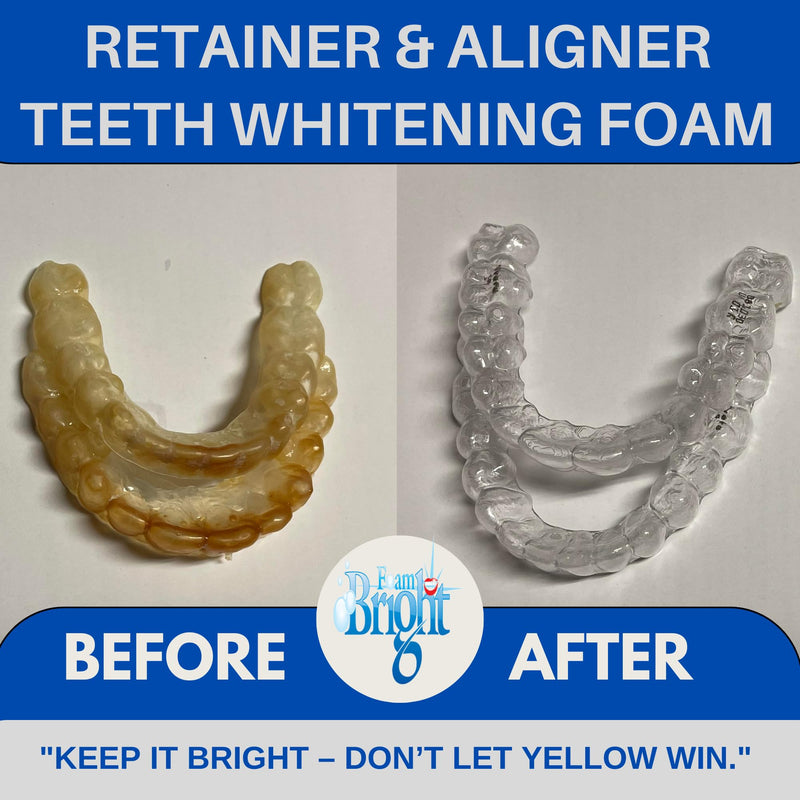 Aligner & Retainer Cleaner Foam Bright, Teeth Whitening Foam, Great for Invisalign, Candid, Byte, Night Guard, Mouth Guard, Dentures, Whitener, Toothpaste & Braces Cleaner, Peroxide Free 1 Unit