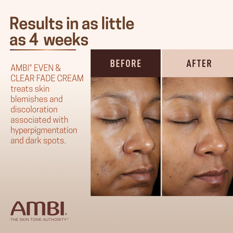 Ambi Even & Clear Fade Cream, Hydroquinone-free, Hyperpigmentation Treatment, Dark Spot Corrector, Results In As Little As 4 Weeks, Niacinamide, Aloe Vera, Vitamin C, 1 Fl Oz 1 Fl Oz (Pack of 1)