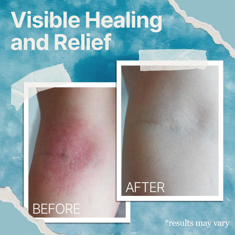 [Australia] - Natural Soothing Cream - Sea Moss Colloidal Oats - for Eczema Psoriasis Prone Skin - Minerals from The Sea - for Sensitive Skin - Hydrating Eczema Cream for Dry Skin (4 Oz) 