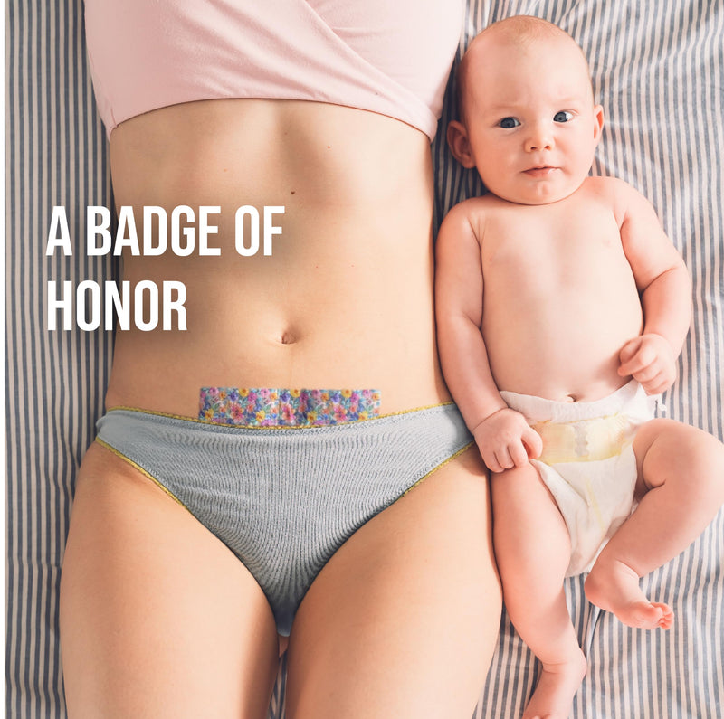 [Australia] - Quitch Silicone Scar Sheets for Surgical Scars, Silicone Scar Tape, C Section Recovery Must Haves, Tummy Tuck Recovery Must Haves, Postpartum Essentials Scar Treatment (Floral) 4x150cm Floral 