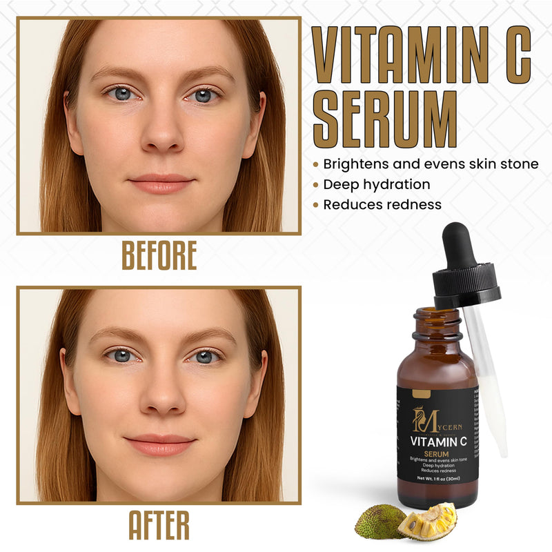 Vitamin C Serum for Face – Brightening & Hydrating Face Serum, Non-Greasy, with L-Ascorbic Acid & Ferulic Acid, Antioxidant Skin Care for Radiant, Smooth Skin, 1 fl oz