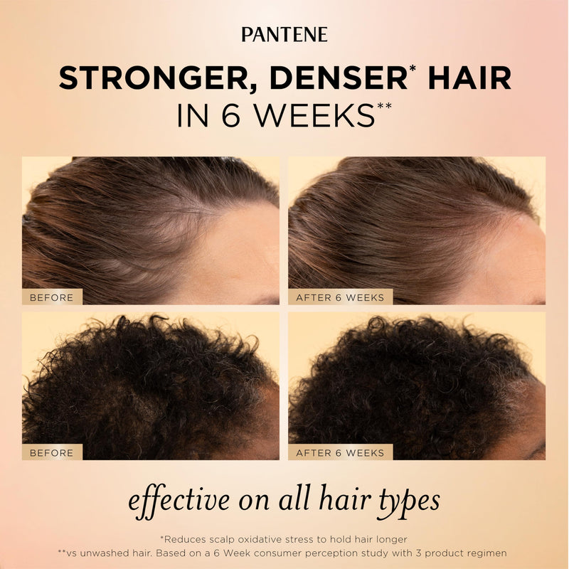 Pantene Abundant & Strong Daily Scalp Serum, Strengthens Scalp’s Hold on Roots, 2 oz