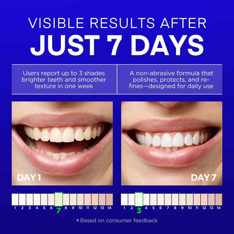 [Australia] - PearlSmile Hydroxyapatite Niacinamide Whitening Toothpaste – 10% Nano-Hydroxyapatite (nHAp) + 5% Niacinamide – Gently Whitens, Strengthens Enamel & Freshens Breath – Fluoride-Free, 4.2oz (2-Pack) 4.2 Ounce (Pack of 2) 