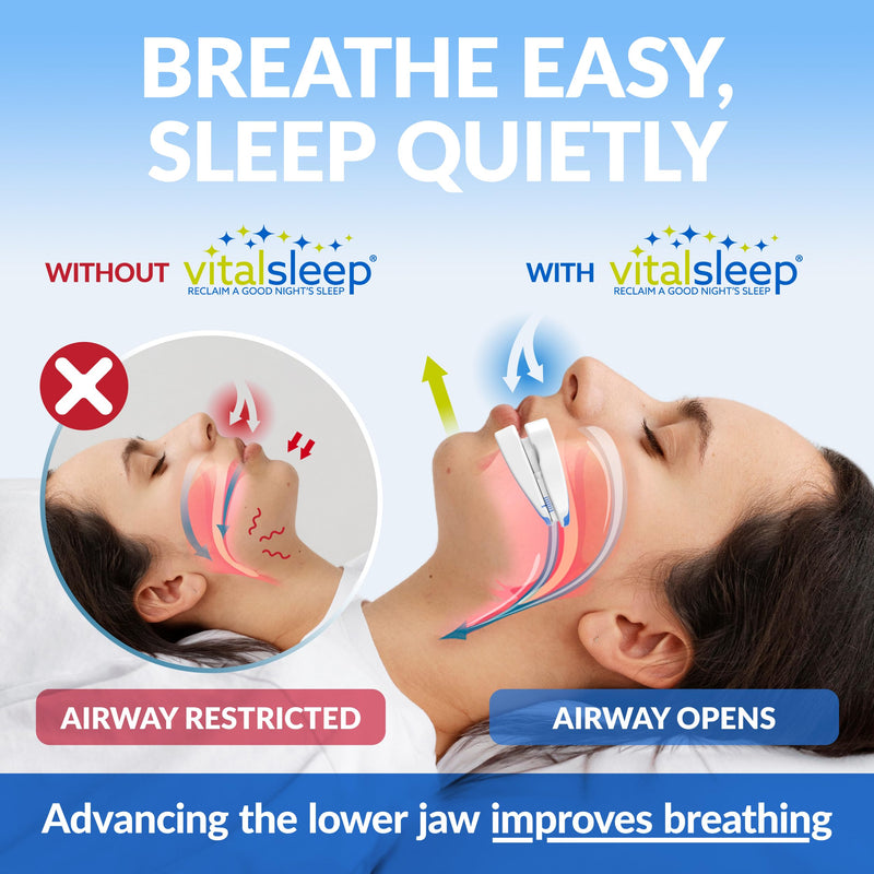 [Australia] - VitalSleep Anti-Snoring Mouthpiece, Women's Size – Adjustable, Custom-Fit Snoring Solution – Comfortable FDA-Cleared Sleep Aid for Better Rest – Made in The USA 