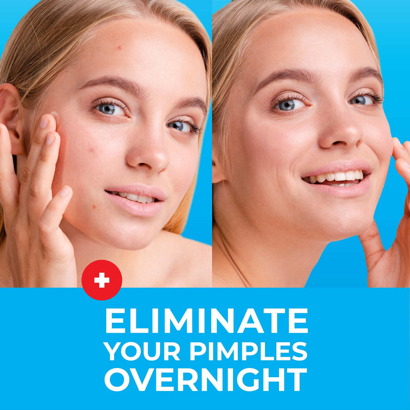 [Australia] - KEYCONCEPTS Pimple Patches for Face (120 Patches), Hydrocolloid Acne Patches with Tea Tree Oil, Pimple Patch Pimple Stickers - Hydrocolloid Patch Acne Dots - Acne Pimple Patches For Face - Zit Patches Hydrocolloid and Tea Tree 1 Count (Pack of 120) 