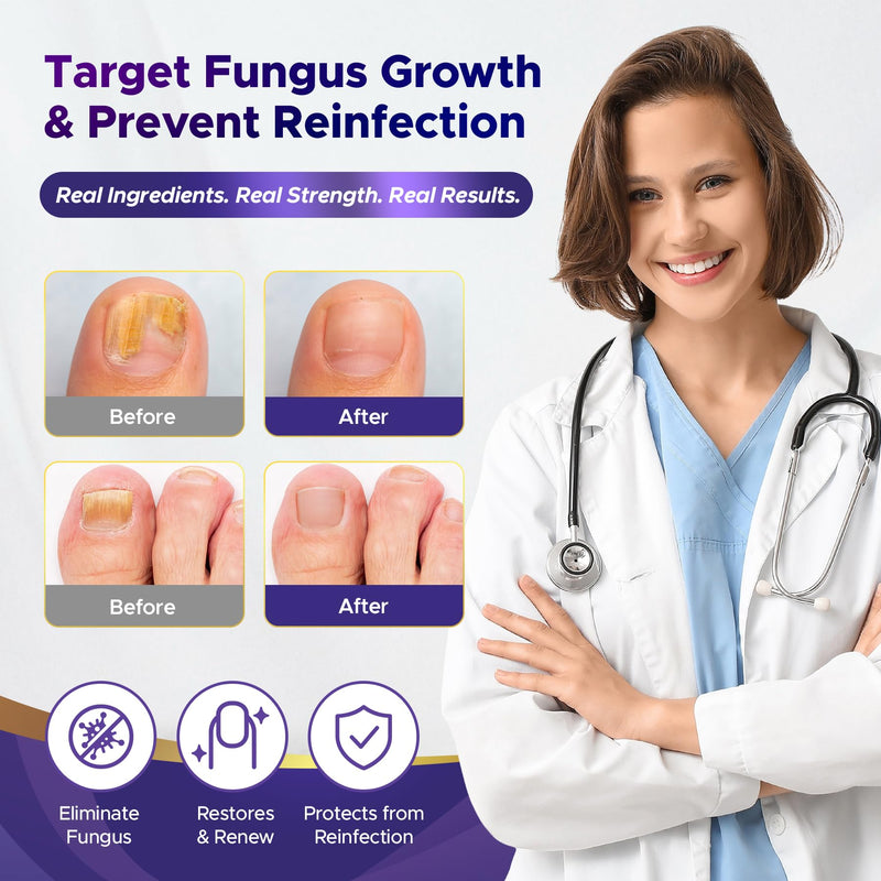Toenail Fungus Treatment : Extra Strength 25% Undecylenic Acid Toe and Fingernail Fungus Removal - Fast Acting Fungal Nail Revitalizer with Tea Tree Oil (0.5 Fl Oz (Pack of 2)) 0.51 Fl Oz (Pack of 2)