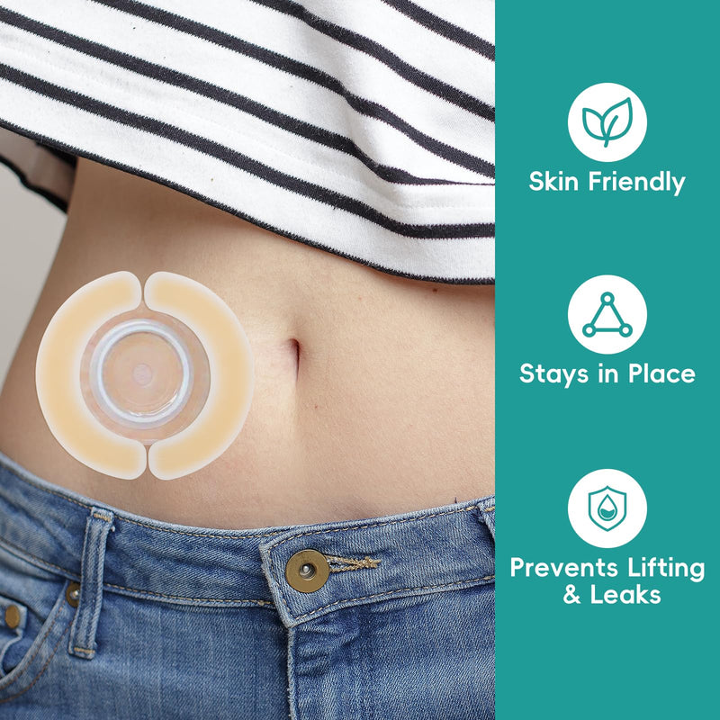 [Australia] - 40 PCS Ostomy Barrier Strips,Ostomy Supplies,Elastic Hydrocolloid Waterproof Leak - Skin Adhesive Ostomy Barrier Tape for Colostomy Stoma Bags 40 Pcs 