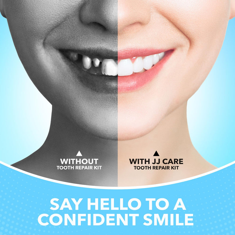[Australia] - JJ CARE Tooth Repair Kit Zinc Oxide Eugenol Dental Cement, Temporary Dental Care Kit for Tooth Repair, Tooth Cement for Crown, Bridges and Missing Tooth 