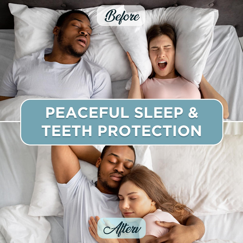 [Australia] - Mouth Guard for Grinding Teeth at Night: Night Guards for Teeth Clenching Custom Fit for Nighttime Protection - 4 Pack 20 Cleansing Tablets 