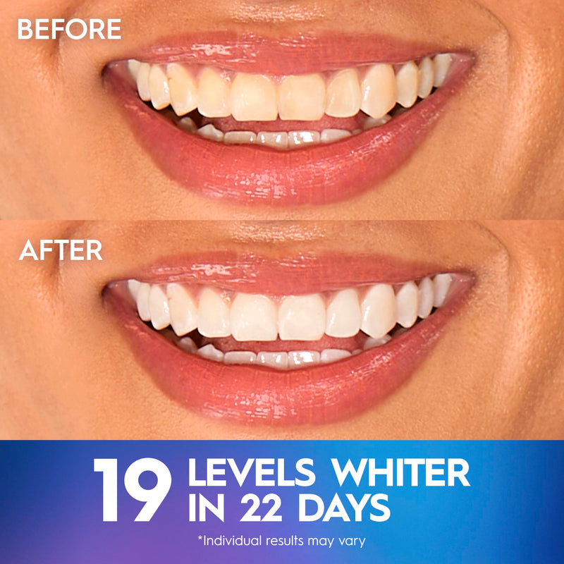 Crest Teeth Whitening Strips, Crest 3D Whitestrips Professional Effects, Enamel Safe Teeth Whitening Kit, 22 Treatments (44 Strips), Professional-Level Whitening, 19 Levels Whiter 44 Count (Pack of 1)