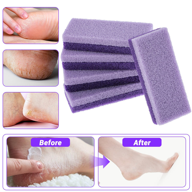 [Australia] - JJUNW Pack of 5 Pumice Stone for Foot Care, Double-Sided Pumice Stone Foot Care Callus Remover and Scrubber for Hard Skin on Feet and Body, Exfoliating and Smoothing the Skin (Purple) Purple 