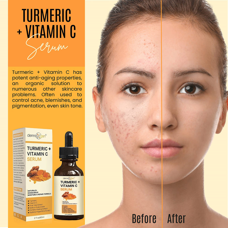 Turmeric Serum for Face + Glow-Boosting Vitamin C Serum –Organic Moisturizer for Acne, Dark Spots & Clear Skin– Boosts Hydration for Dry & Tired Skin – Anti-Aging Formula for Glowing Skin, 2 FL OZ 2 Fl Oz (Pack of 1)