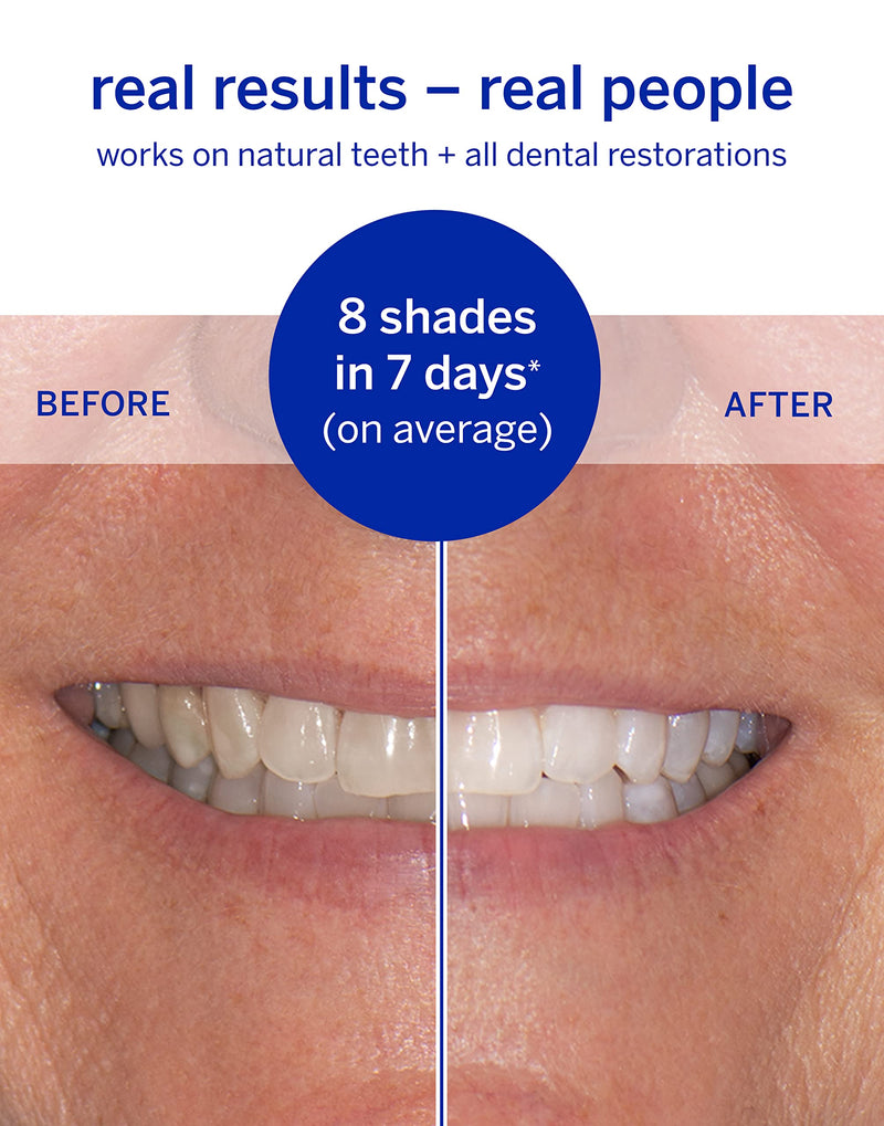 Supersmile Whitening Kit, Dissolving Strips + Toothpaste + Accelerator | 15-Min Dissolving Strips, Pro Toothpaste + Accelerator, Whitens Up to 8 Shades, Complete Whitening System, Daily Use