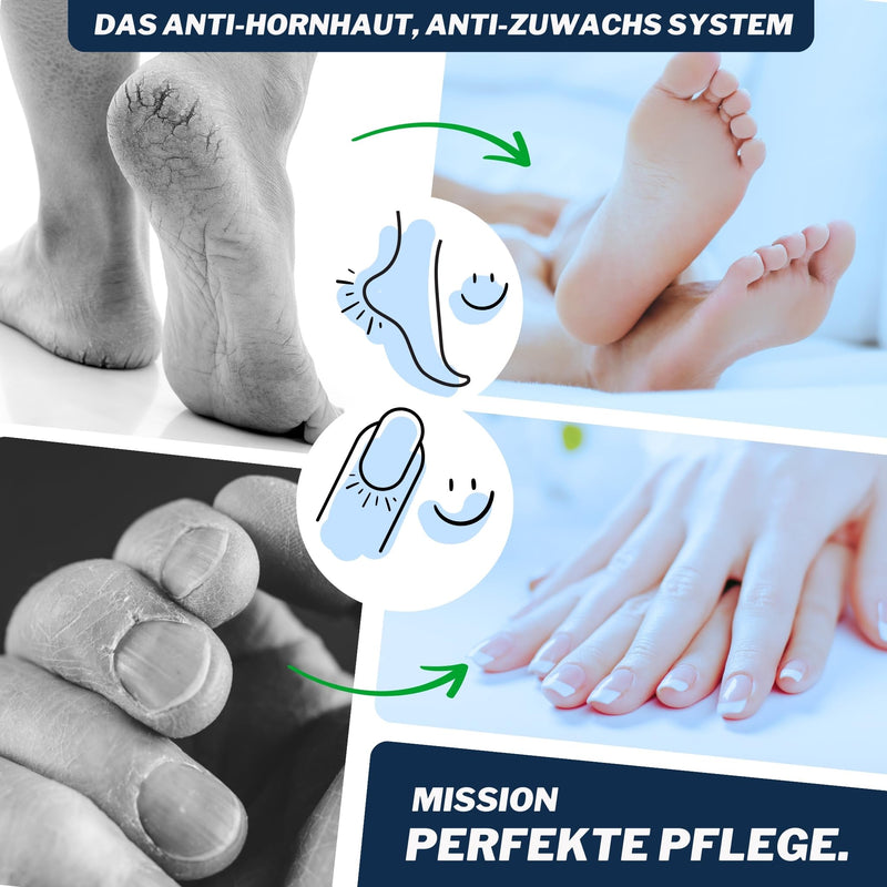 [Australia] - Mr. Fuss® Starter Kit 7-piece Edition Excell callus remover system package for gentle removal, including for manicures 