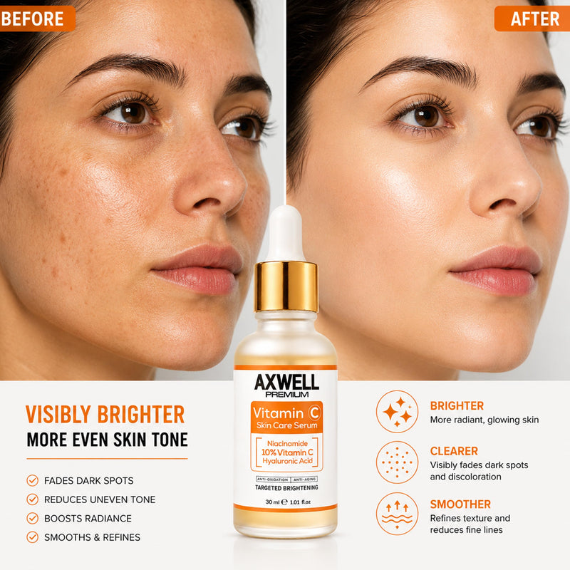 Axwell Vitamin C Serum for Face – 10% Vitamin C + Niacinamide – Daily Glow & Radiance Facial Serum with Hyaluronic Acid – Hydrating Skin Care for Even Tone (1 fl oz)