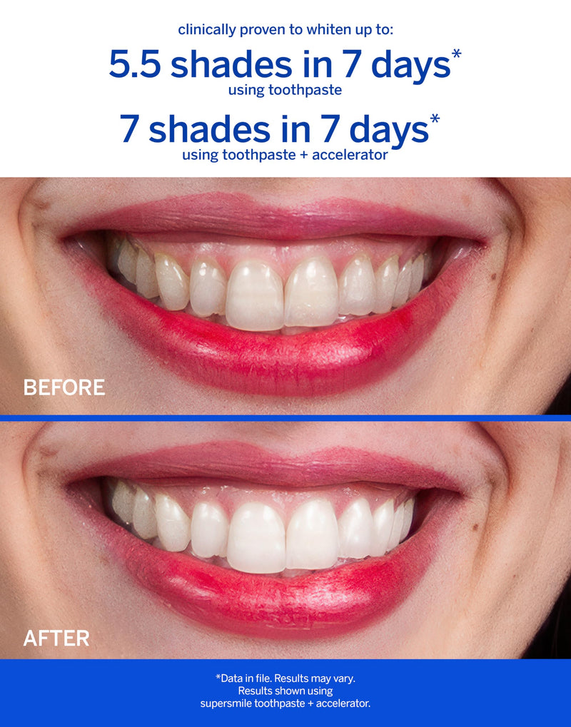 [Australia] - Supersmile Professional Whitening Toothpaste – Fluoride Toothpaste for Visibly Whiter Teeth – Whitens up to 6 Shades Peppy Mint 8 Ounce (Pack of 1) 