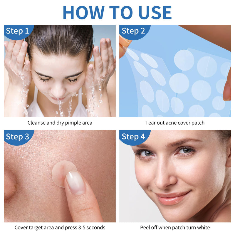 [Australia] - Pimple Patches for Face, 4 Size 300 Counts Acne Patches, Hydrocolloid Patches for Covering Zits and Blemishes, Spot Stickers with Salicylic Acid, Tea Tree Oil & Calendula Oil 