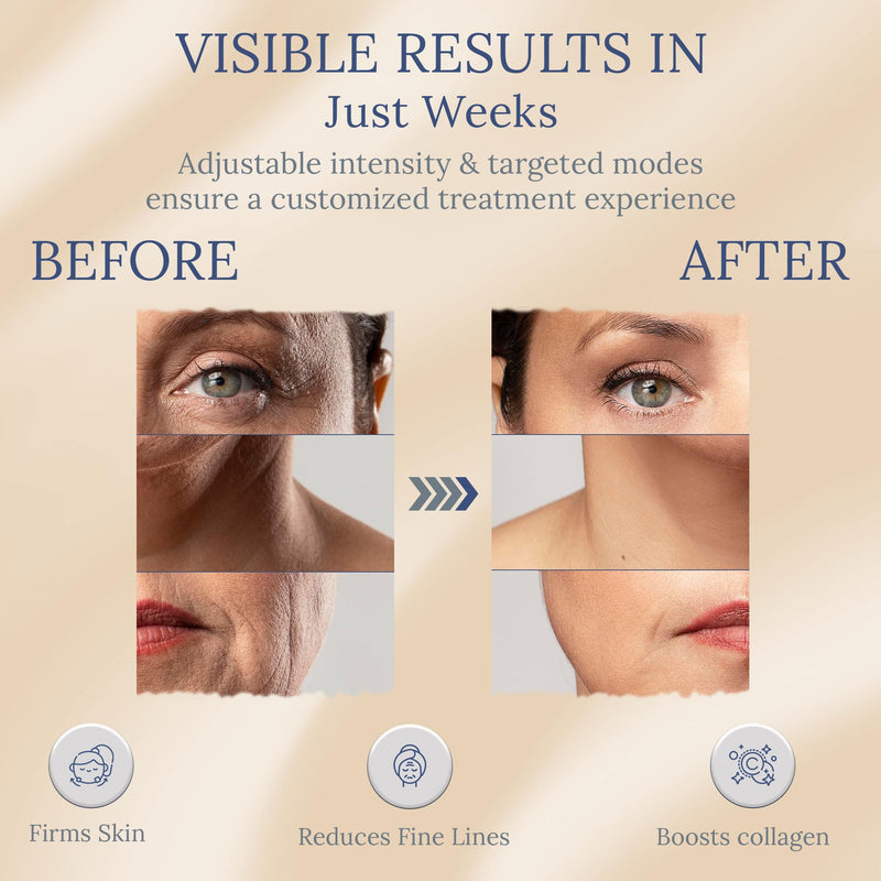 Skin Firming RF Facial Device, 6-in-1 Beauty Device for Home Use, 5-Level Skin Rejuvenation and Toning Tool for a Radiant Glow