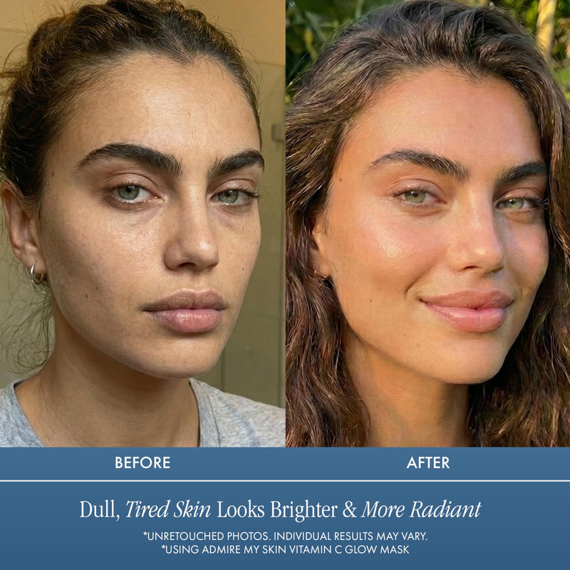 Admire My Skin Vitamin C Glow Mask Brightening Face Mask 2oz | Hydrating Skin Care with Glycolic Acid, Lactic Acid & Squalane for Glowing Skin & Smooth Even Tone