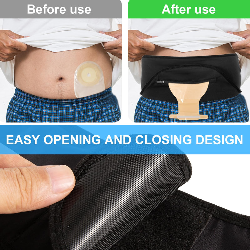 [Australia] - Ostomy Belt | Stealth Belt Ostomy Bag Cover | Ostomy Wrap for Sport & Swiming | Ostomy Support Belts for Men & Women | Colostomy Bag Cover Belt | Inner Pocket to Hold Ostomy Pouch | Ostomy Supplies -M Black Medium 