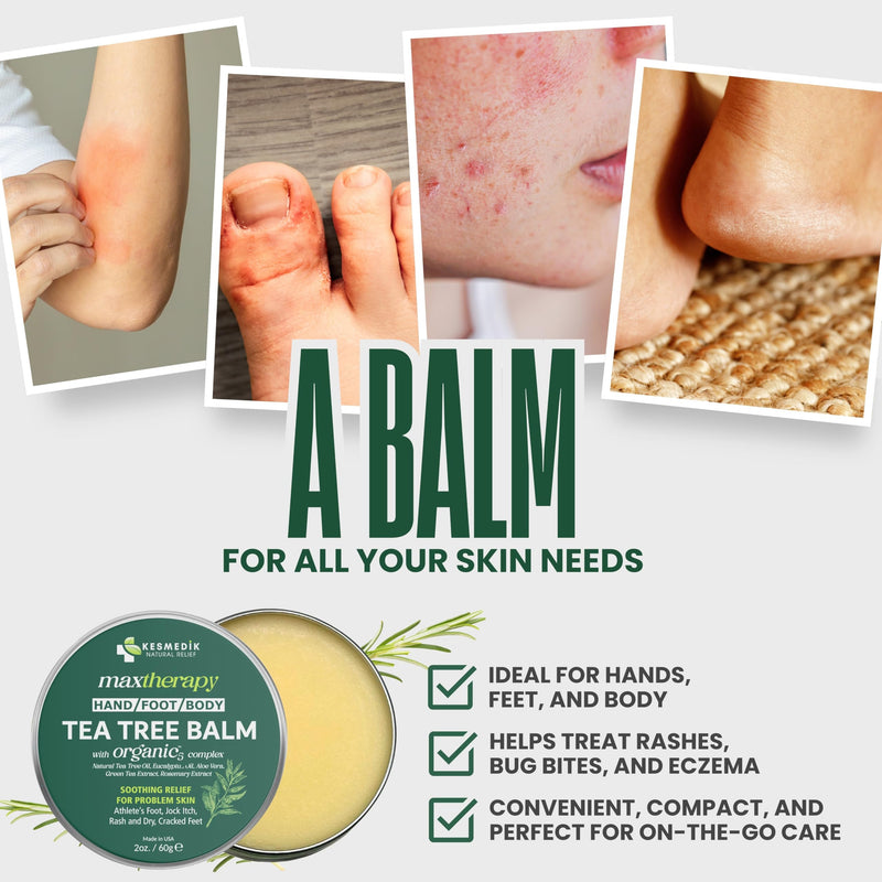 KESMEDIK Tea Tree Oil Balm for Skin, Soothes Itching, Rashes & Dry Skin, Antifungal Defense for Athlete’s Foot, Jock Itch, Chafing, Bug Bites & Eczema, Natural, Effective & Safe for All Ages, 2-Pack 2 Ounce (Pack of 2)