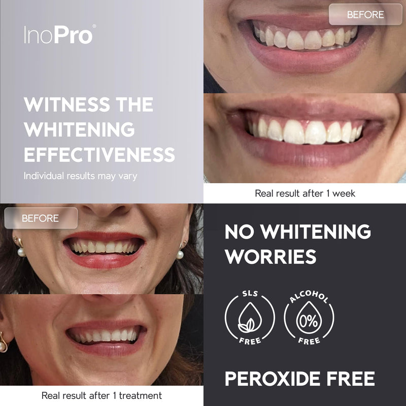 InoPro Natural Teeth Whitening Strips Kit 14 Treatments - Sensitive Teeth Whitener, Peroxide Free with Papain, Bromelain, Coconut Oil, White Strips for Teeth Whitening (28 Strips) 28 Count (Pack of 1)