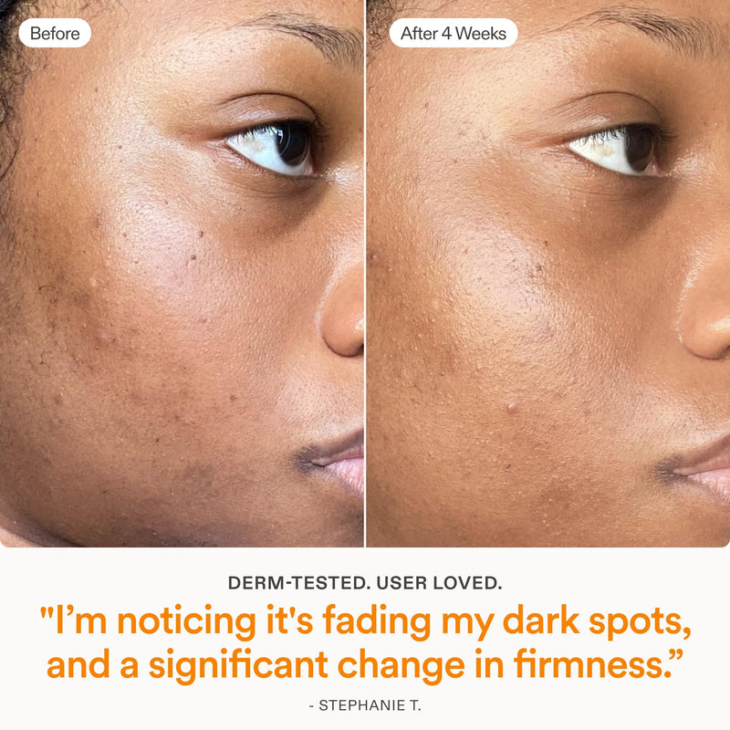 Skinfix Brighten + Firm 15% Vitamin C Serum for Face - Visibly Fades Dark Spots & Fine Lines - Safe for Sensitive & Aging Skin