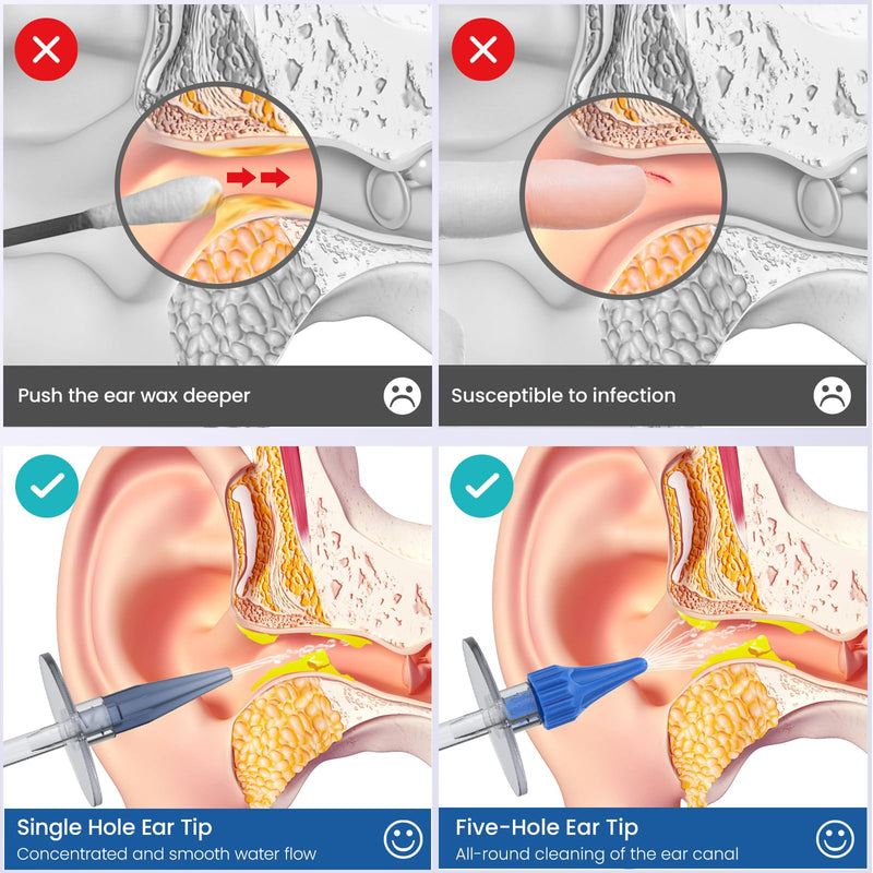 [Australia] - Ear Wax Removal, Ear Wax Removal Tool, Ear Cleaning Kit, Manual Ear Irrigation Flushing System, Safe and Effective to Clean Ear Built Up Wax 