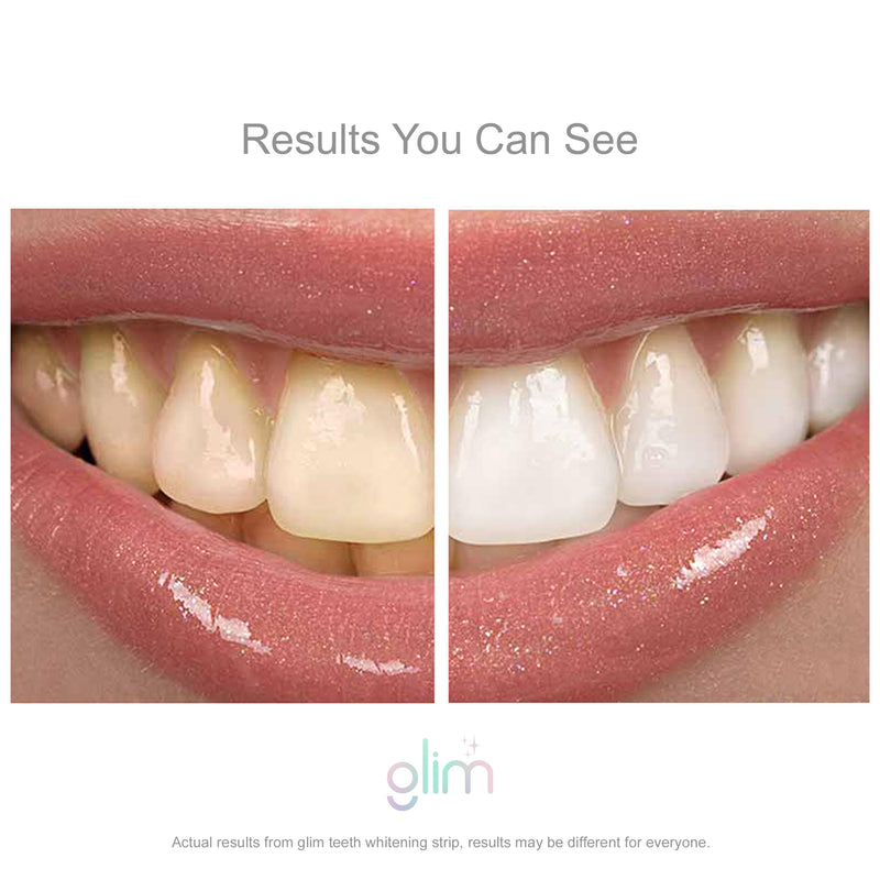 [Australia] - Professional Teeth Whitening Strips 42 White Strips (21 Pack), Hydrogen-Free, Non-Toxic, Dentist Approved, Sensitivity Free for Sensitive - Vegan & Cruelty Free - (Mint) 