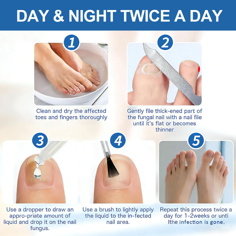 Extra Strength Toenail Fungus Treatment 1oz, Restore Yellow Nails | For Toenails & Fingernails, Gentle Non-Irritating, Precision Brush Applicator, Fast-Absorbing, Athlete's Foot Relief