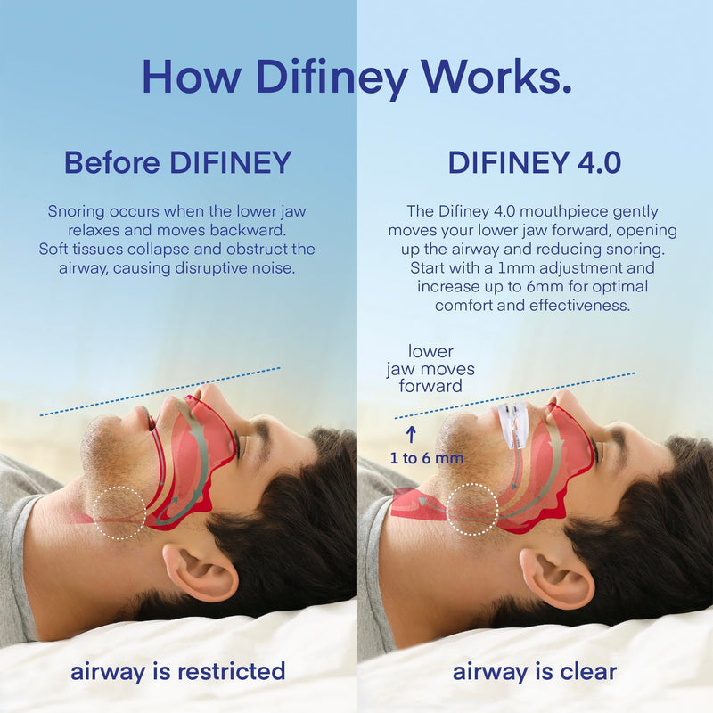 [Australia] - Advanced Anti Snoring Device 4.0 Clear: Adjustable Custom-Fit Anti Snoring Mouthpiece Mouth Guard for Men and Women - Effective Comfortable Anti Snore Solution 