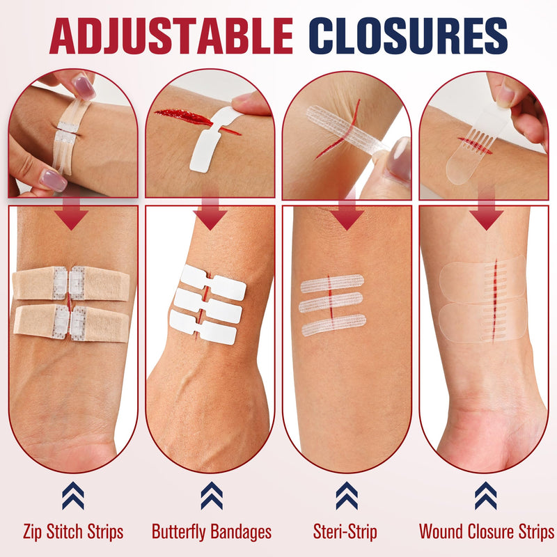 [Australia] - Emergency Wound Closure Strips - HSA or FSA Eligible - Mountree 4 Types Easy to Use Laceration Closure Kit - Stitchless & Painless Sutures Butterfly Bandaids 35PCS 