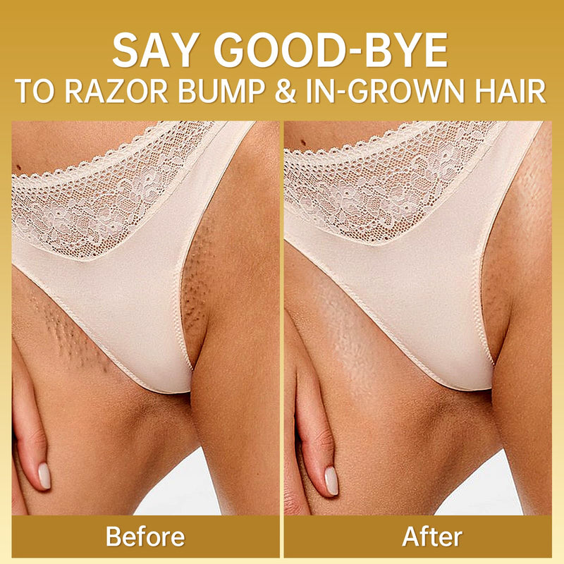 [Australia] - LA.PERSONAL Ingrown Hair Treatment, Razor Bump Treatment for Men and Women, Razor Bump and Burn Remover Ingrown Hair Oil for Bikini Area, Legs and Underarm Area After Shave 40 ML/1.4 FL OZ 