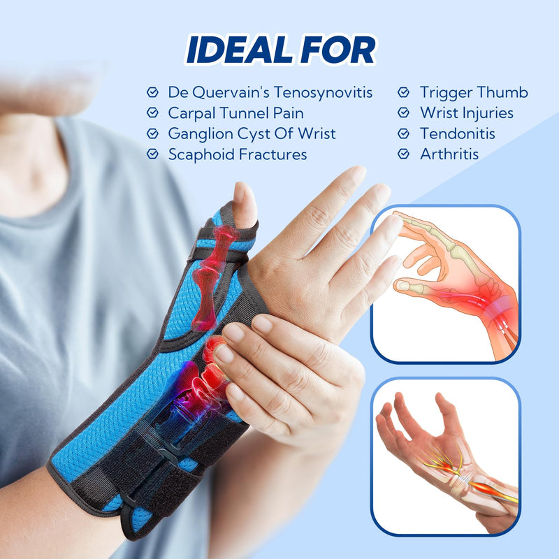Thumb Spica Splint, De Quervain's Tenosynovitis Brace, Carpal Tunnel Wrist Brace with Thumb Support, Wrist and Thumb Brace for Trigger Thumb, Arthritis, Wrist Fractures, Injuries, Right-L L