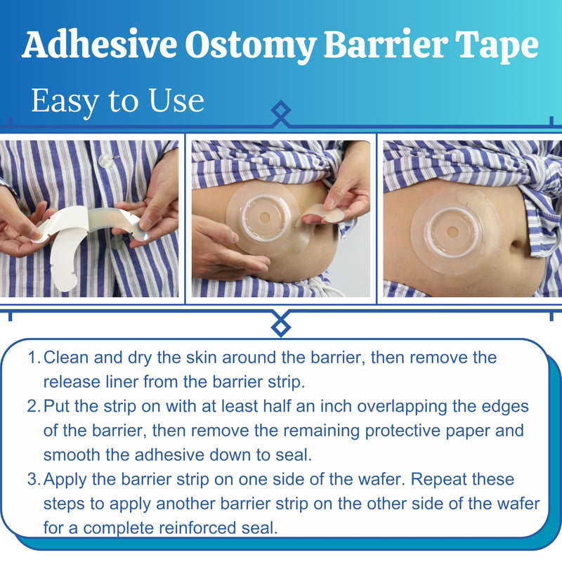 [Australia] - 20pcs Ostomy Barrier Strips, Elastic Medical Hydrocolloid Adhesive Tapes, Ostomy Supplies Wafer Extenders for Colostomy Bags 