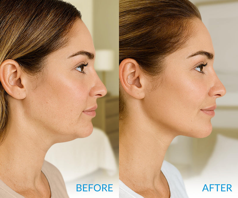 [Australia] - Stylia MaxiLift V-Line Lifting Collagen Face Mask - Advanced Double Chin Reducer - Jawline Shaper - Neck Firming and Tightening Mask with Hyaluronic Acid & Aloe Vera - Chin Strap for Sleeping (10PC) 10 Count (Pack of 1) V-Line MaxiLift 