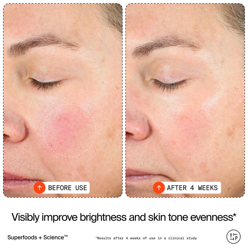 Youth To The People 15% Vitamin C Bright Cell Face Serum (1 fl oz) | Brightening Facial Serum for Even Tone - Niacinamide + Adenosine + D-Ribose, Fade Dark Spots, Sensitive + Acne Skin Approved