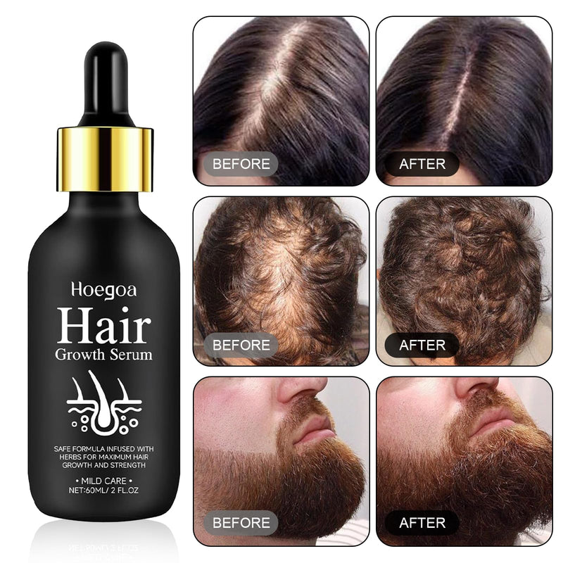 [Australia] - Beard Growth Kit Roller Beard Growth Agent Men 60ml Beard Roller Growth Set, Beard Growth is Suitable for Many Skin Types and Can Be Used as a Gift for Men 