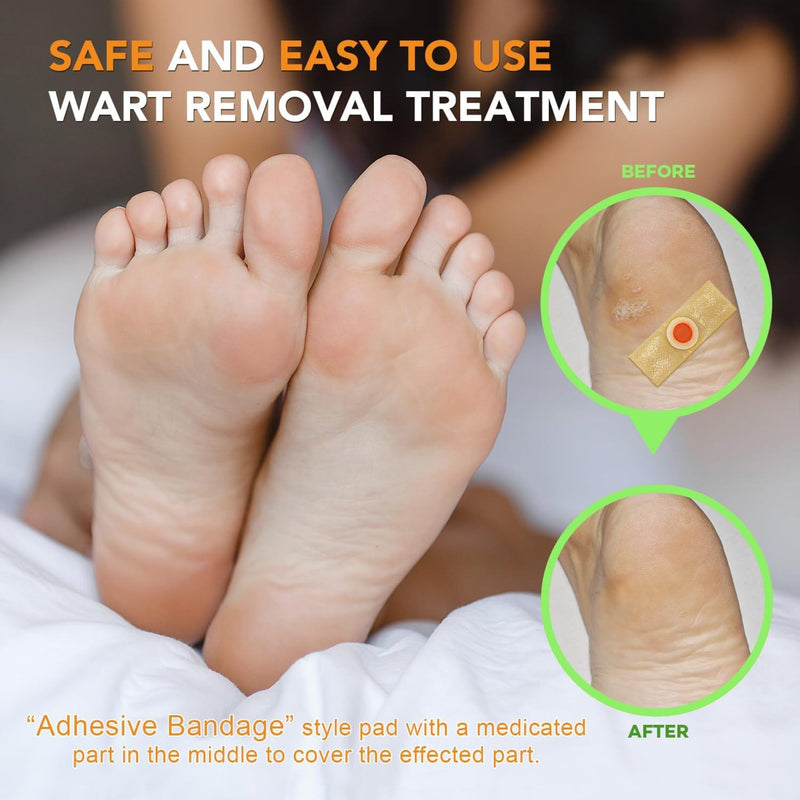 [Australia] - Wart Corn Remover Pads for Feet: 42 Pack 40% Salicylic Acid Extra Strength Bandages for Plantar Warts Corns Small Callus on Feet Hands Toes - Safe Effective Treatment for Adults Teens Blue (42 Pads) 42 Pads 