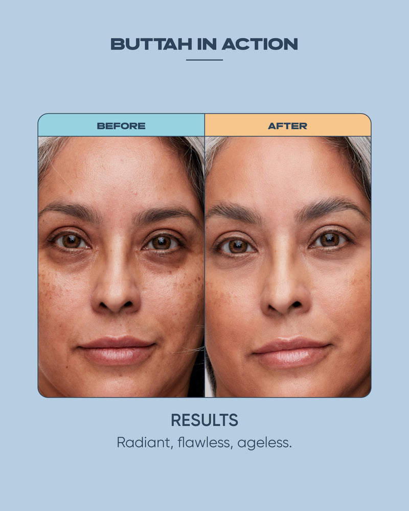 Buttah Skin Everlasting Retinol Oil - Retinol Vitamin Serum For Face - Nourish, Hydrate, and Rejuvenate Your Skin with this Retinol Serum - Facial Serums For Dark Spots