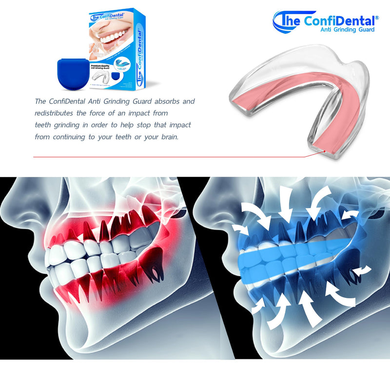 [Australia] - The ConfiDental Mouth Guard for Teeth Grinding and Clenching - Moldable Dental Nightguard Protection for Mild to Heavy Teeth Grinders at Night - 5-Pack (3 Regular, 2 Heavy-Duty) Blue Box (5 Pcs) - V.1 Model A (3 pcs) + Model C (2 pcs) – V.1 