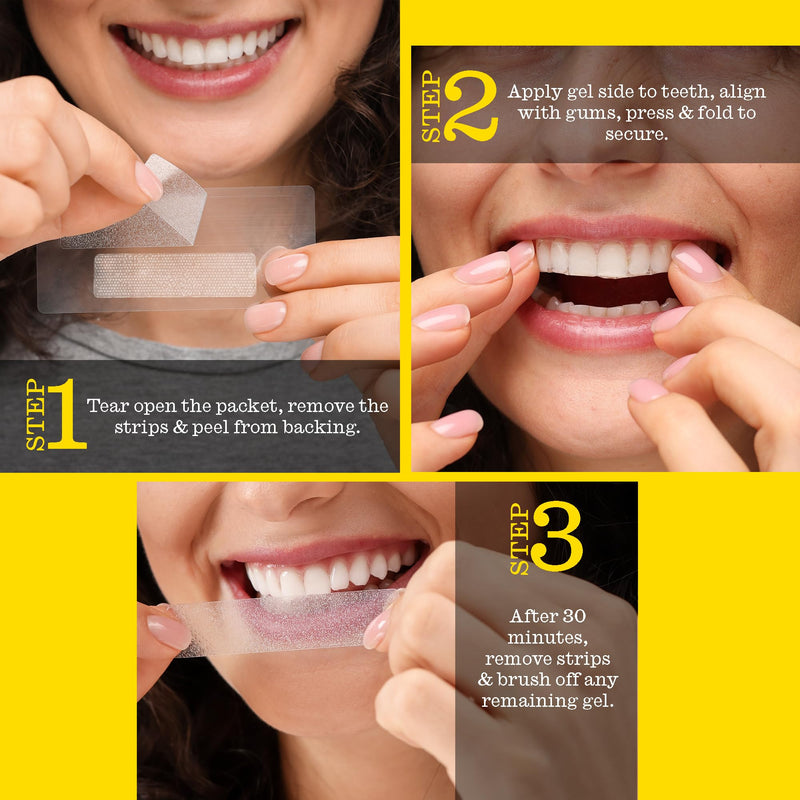 Twice Teeth Whitening Strips Kit – 30-Minute Quick & Gentle Teeth Whitening – 20-Day Treatment – No-Slip, Mess-Free, Gentle on Enamel – Sweet Mint Flavor – Vegan 40 Count (Pack of 1)