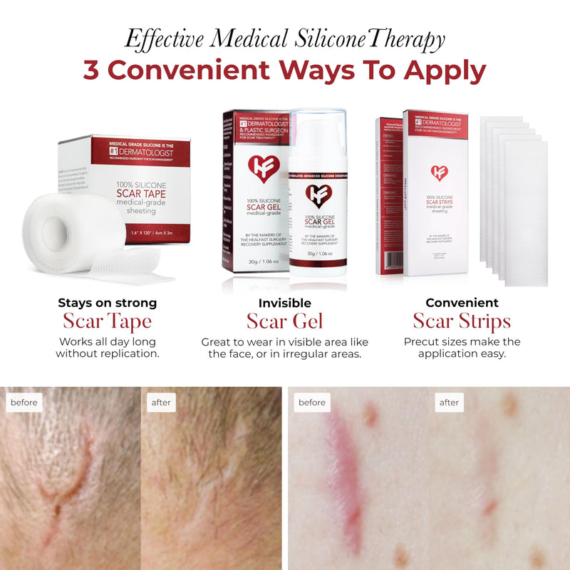 [Australia] - Physician Formulated Silicone Scar Sheets - Advanced Crosspolymer Medical Grade Silicone Scar Tape for Surgery, C Section, Keloids & Hypertrophic Scars - Silicone Tape For Scars 