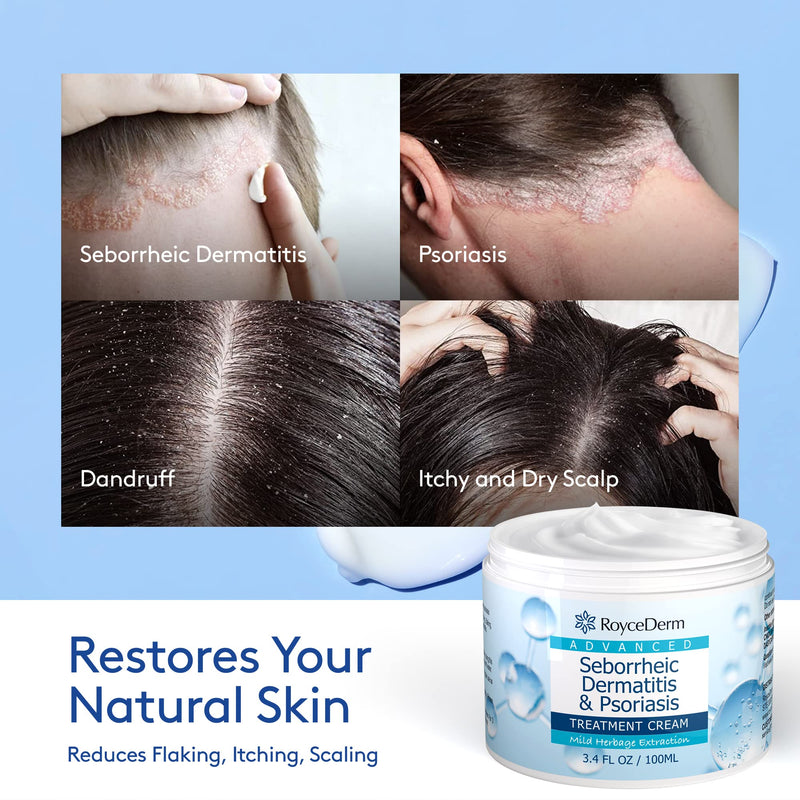 [Australia] - Roycederm Seborrheic Dermatitis Cream, Scalp Treatment for Psoriasis, Folliculitis, Dry Scalp, Dandruff, Anti-Itch Cream for Soothing Relief 