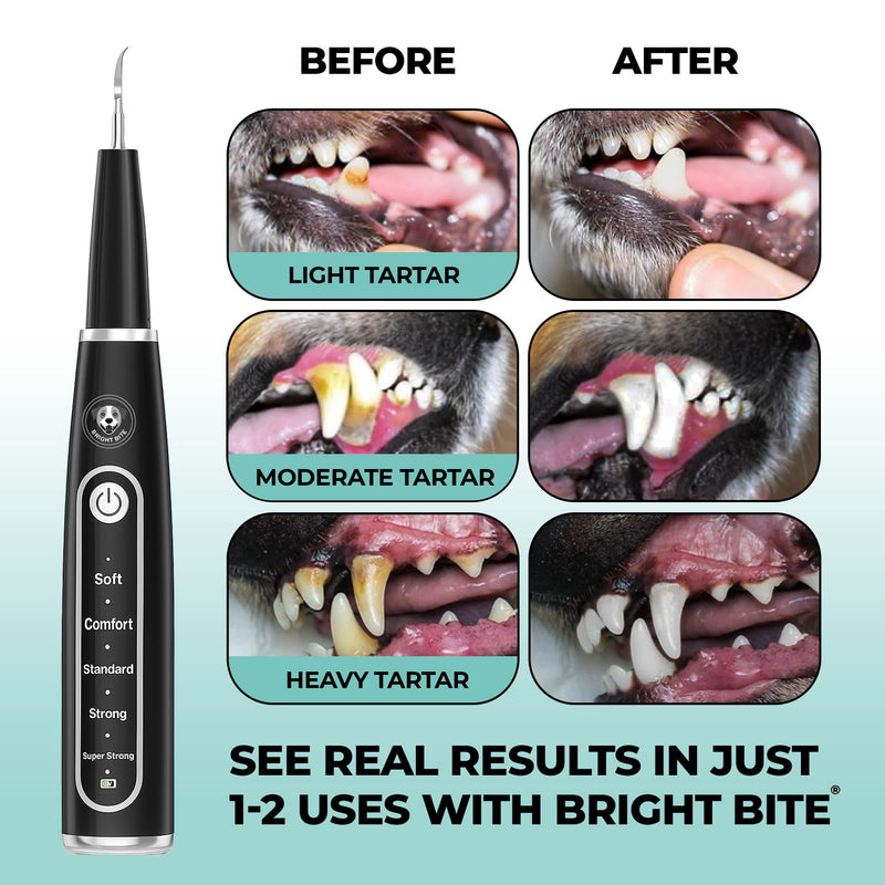 BRIGHT BITE™ | Ultrasonic Plaque Remover for Teeth | Dog Toothbrush; Cat Toothbrush | Quiet Tartar Remover | Dog Accessories | Teeth Cleaning Tools| Doggie Dental Scaler | Dental Tools | USB-C