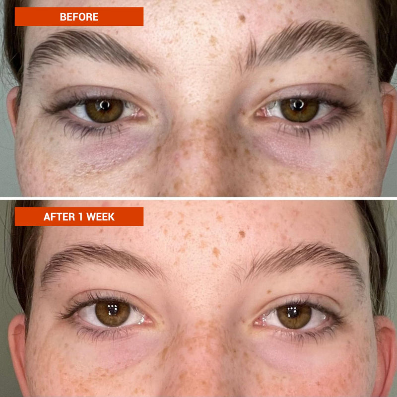 BeautyStat Vitamin C Eye Cream - Caffeine Eye Perfector for Dark Circles | 5% Vitamin C Under-Eye Cream with Caffeine - Reduces Puffiness & Circles 1